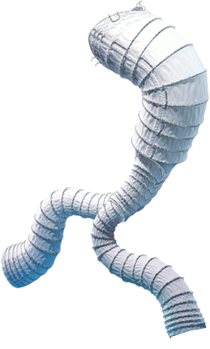 腹主动脉覆膜支架系统