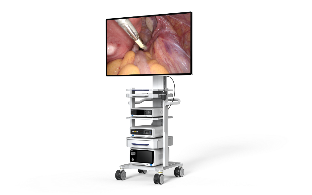 三维电子胸腹腔内窥镜系统II代