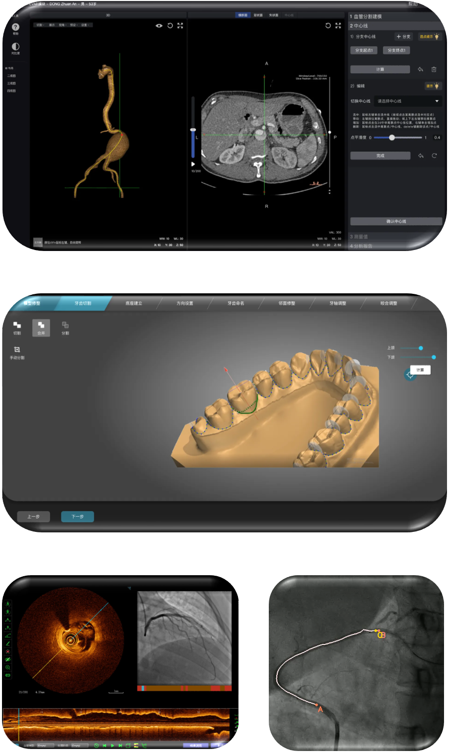 人工智能疾病辅助分诊/诊断软件