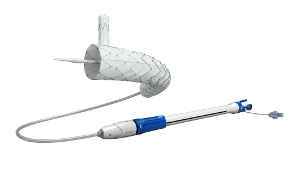 分支型主动脉覆膜支架系统